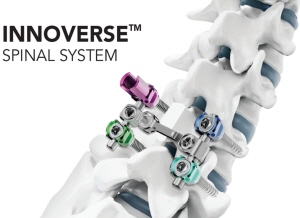 ▲ 시지메드텍은 자사의 척추 고정 장치 ‘이노버스 스파이널 시스템(INNOVERSE Spinal System)’이 미국 식품의약국(FDA) 승인을 획득한 데 이어, 최근 미국 병원에서 첫 수술에 성공적으로 적용됐다고 밝혔다.